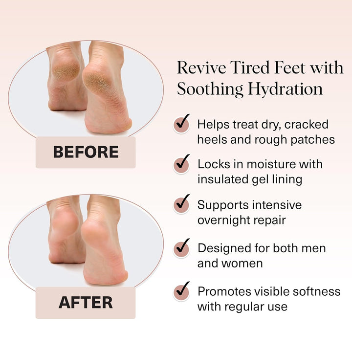 Moisturizing Socks for Cracked Heel Treatment – Reusable Spa Socks for Women & Men with Insulated Gel Lining - Overnight Heel Socks for Dry Cracked Feet, Hydrating, Open-Toe Design - 1 Pair