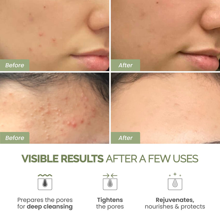 Korean Skincare Clay Mask – Hydrating Mud Mask with Avocado & Superfoods, Dermatologist-Tested for Face & Body – Vegan, 3.4 Oz/100Ml