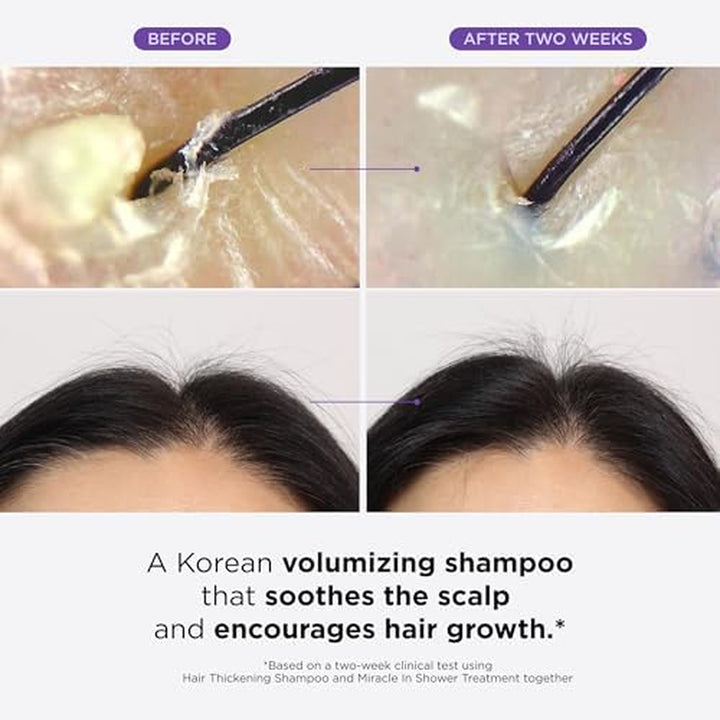 Hair Thickening Shampoo, Korean Hair Care with Biotin, Rosemary Oil to Help Volumize Thinning, Damaged Hair, Hydrate Hair and Scalp, Biotin Shampoo, Scalp Revitalizing Solution