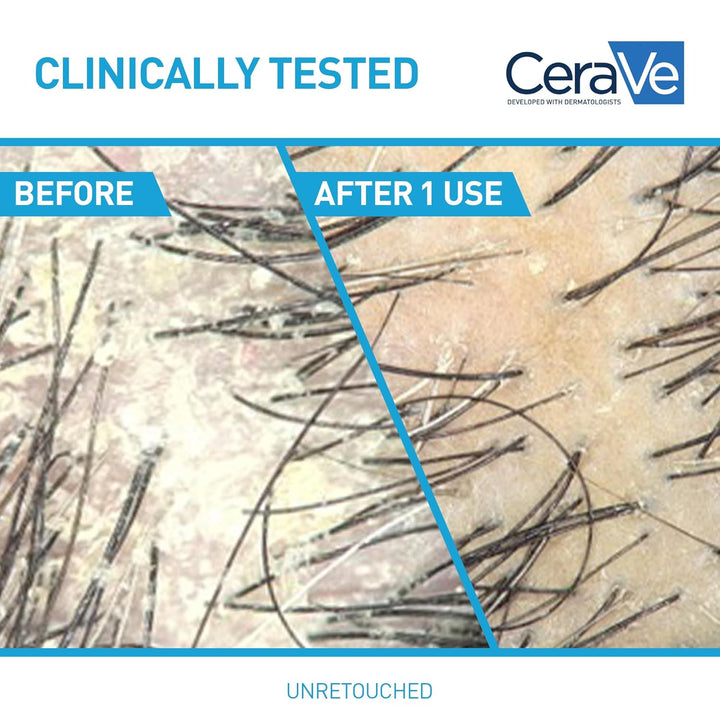 2 in 1 Hydrating anti Dandruff Shampoo and Conditioner, 1% Pyrithione Zinc Dandruff Treatment, Color Safe & Sulfate Free Shampoo and Conditioner, Helps Eliminate Dandruff & Relieve Itchy Scalp