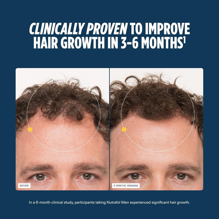 Men'S Hair Growth Supplements, Clinically Tested for Visibly Thicker Hair and Scalp Coverage, Dermatologist Recommended - 1 Month Supply