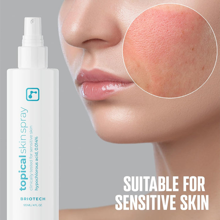 Topical Skin Spray, Hypochlorous Acid Spray for Sensitive Skin, Hocl Facial Mist, Full Body Support against Irritation, Calm Redness, Soothe Foot & Scalp, 8 Oz (1 Pack)