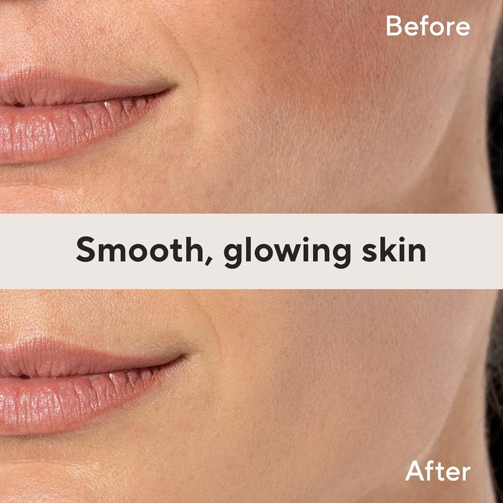 Dermaplane Facial Exfoliator and Hair Remover, Facial Hair Removal for Women, 6 Count