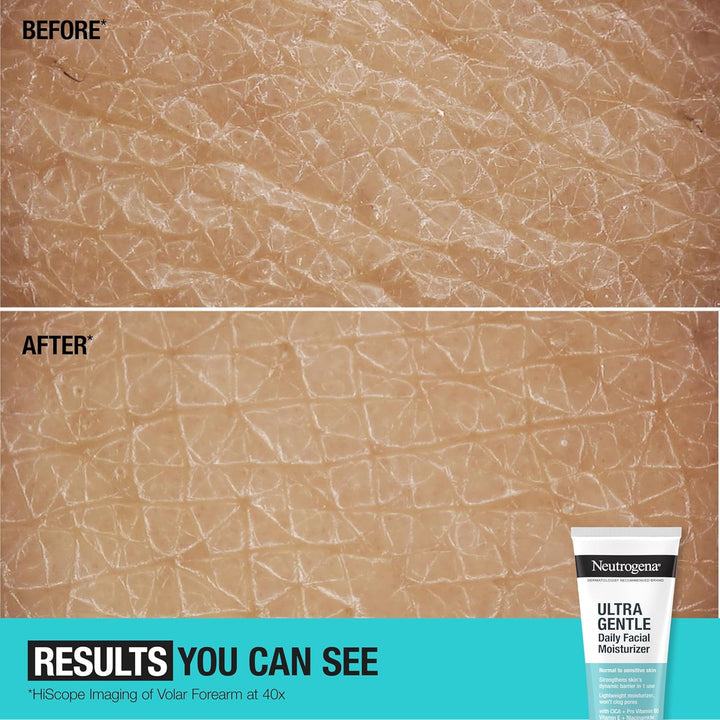 Fragrance Free Daily Facial Moisturizer, Face & Neck Moisturizer for Sensitive Skin with Vitamin B3, Pro-Vitamin B5 & Vitamin E Supports Skin'S Dynamic Barrier, 3.4 Fl. Oz