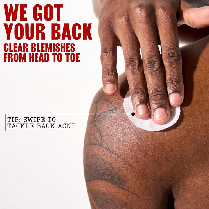 Blemish Clearing Acne Pads, Salicylic Acid Acne Treatment for Face, Pore Reducing, Exfoliating, and Soothing Skincare, Witch Hazel Toner Pads, 60 Ct