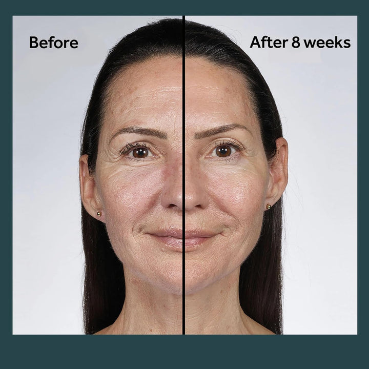 Future Renew Damage Reversal Night Cream - anti Aging Face Moisturizer - Infused with Peptide Technology to Reverse Visible Signs of Damage - Skin Barrier Repair for Dry Skin (1.69 Oz)