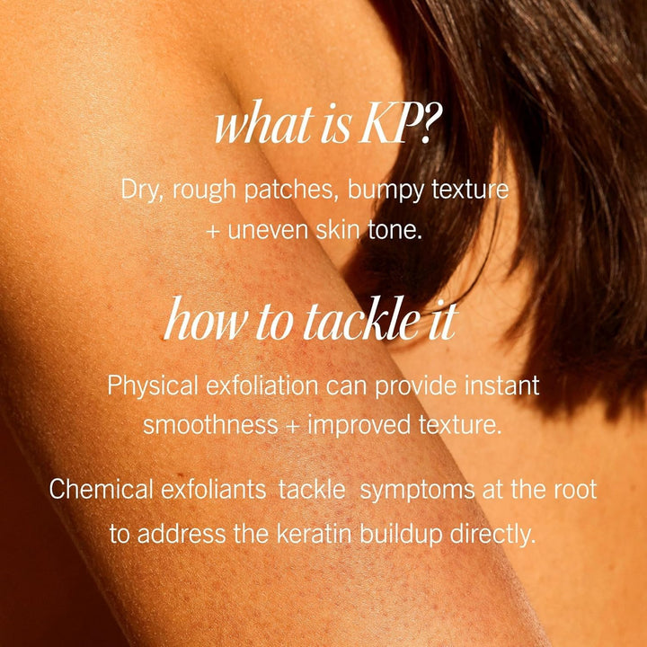 - KP Bump Eraser Body Scrub with 10% AHA, Keratosis Pilaris Skin Exfoliater with Glycolic and Lactic Acids, Helps Reduce Chicken Skin Bumps, Safe for Sensitive Skin, 10 Oz