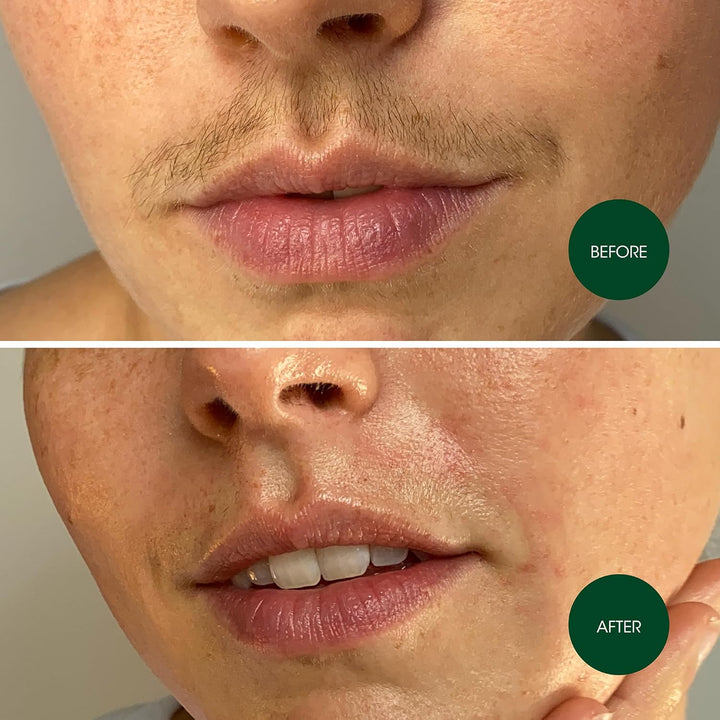 Facial Wax Strips, Fragrance Free, 48 Count (Pack of 2)