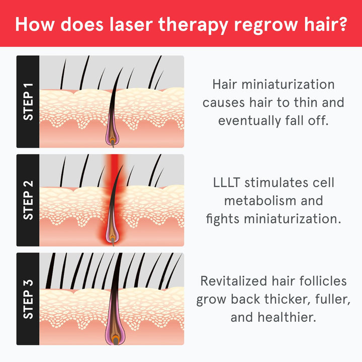 Essential - Laser Red Light Therapy for Hair Growth - FDA Cleared Hair Loss, Hair Thinning & Alopecia Treatment for Men & Women - Laser Cap for Hair Regrowth Stimulate Denser Fuller Hair
