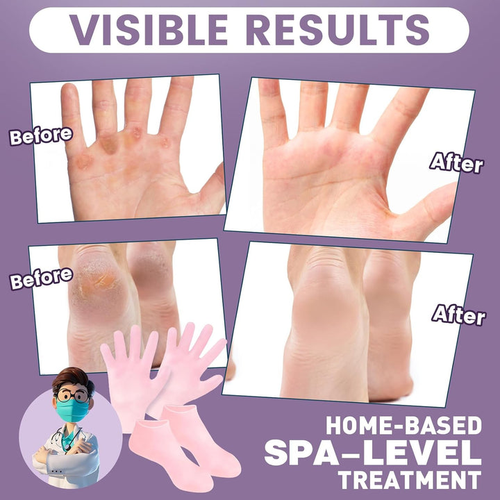 4 Pairs Silicone Socks Gloves Set for Dry Cracked Feet and Hands, Silicone Foot Socks for Women, Moisturizing Feet