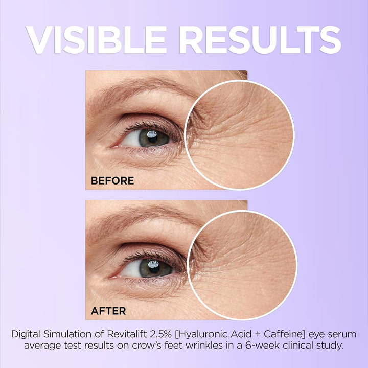 Revitalift Hyaluronic Acid + Caffeine Hydrating Eye Serum for Dark Circles, Fragrance Free .67 Fl. Oz + Moisturizer Sample