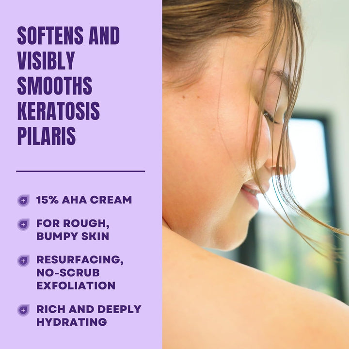 KP Bumps Be Gone - 3 Oz Keratosis Pilaris Moisturizing Cream with 15% Lactic Acid - Exfoliator and Moisturizer for Dry, Rough and Bumpy Skin (Packaging May Vary)