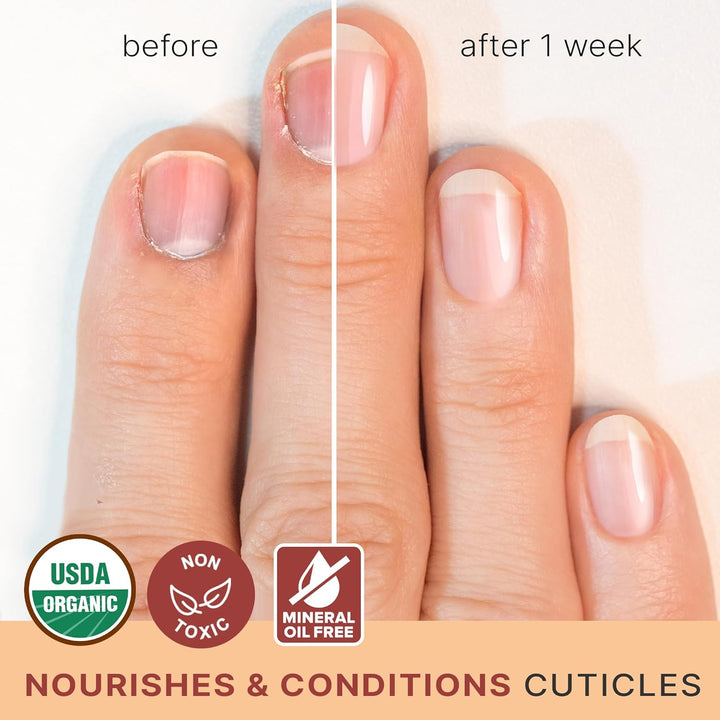 Organic Nail and Cuticle Oil - USA Made Nail Oil for Growth & Strength with Jojoba and Vitamin E, Repair for Damaged Nails & Cuticle Softener Made with Natural Ingredients, Nails Care Products