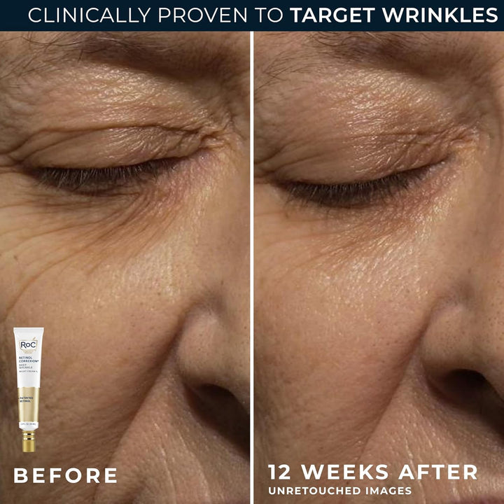 Retinol Correxion Value Set Duo, Deep Wrinkle Anti-Aging Night Face Cream + under Eye Cream for Dark Circles & Puffiness - Retinol Eye Care