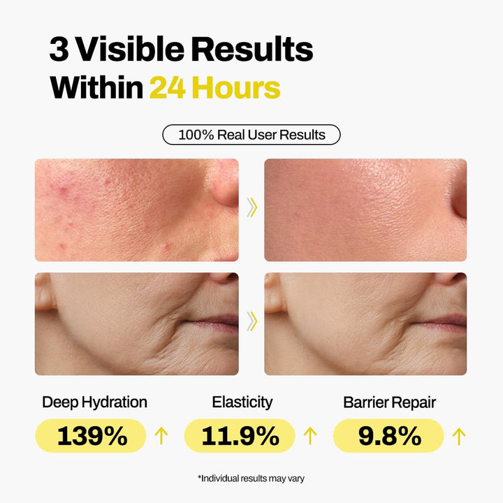 Dermishuttle DD Cream Deep Hydration Intensive Smoothness Face, Neck and Hand with Peptide, Ceramide, Hyaluronic Acid, anti Aging Wrinkles Cream, Korean Skincare Moisturizer (50G)