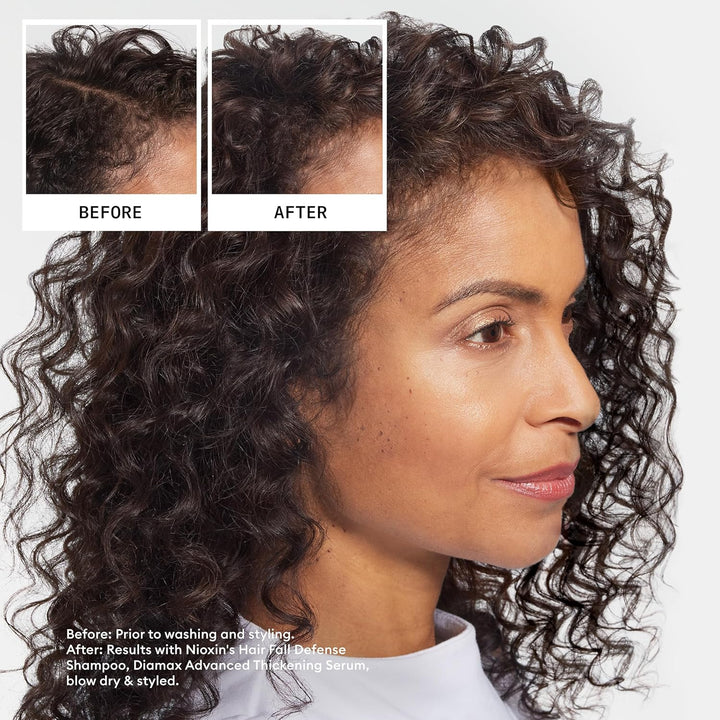 Hair Fall Defense Shampoo | Activates Hair Follicles for Visibly Less Hair Loss| with Lauric Acid, Caffeine, Niacinamide and Sandalore