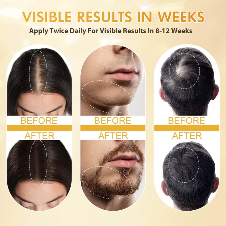 Minoxidil for Men and Women, Hair Growth Biotin Serum with Batana and Rosemary for Hair Beard Regrowth Treatments Extra Strength Hair Loss Solution, Clinically Proven to Regrow Thicker