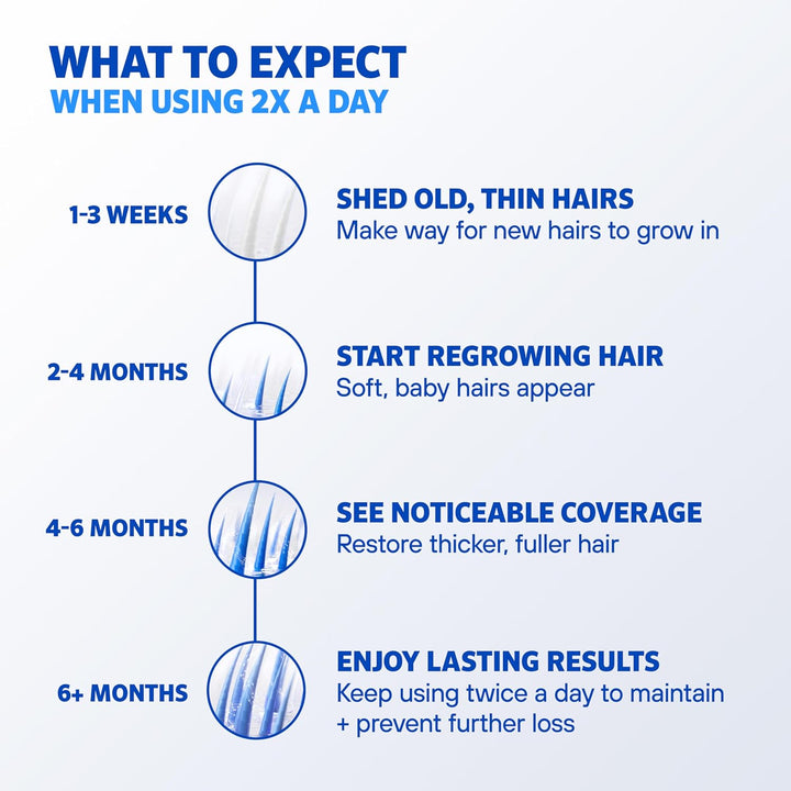 Men’S  Extra Strength 5% Minoxidil, Topical Solution for Thinning & Hair Loss, Clinically Proven FDA Approved Minoxidil for Men Treatment, Regrow Fuller Hair, 3 Month Supply, 3 Bottles