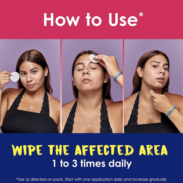 Rapid Rescue Deep Treatment Acne Face Pads, Maximum Strenght with 2% Salicylic Acid Acne Treatment Medicine, 90 Count