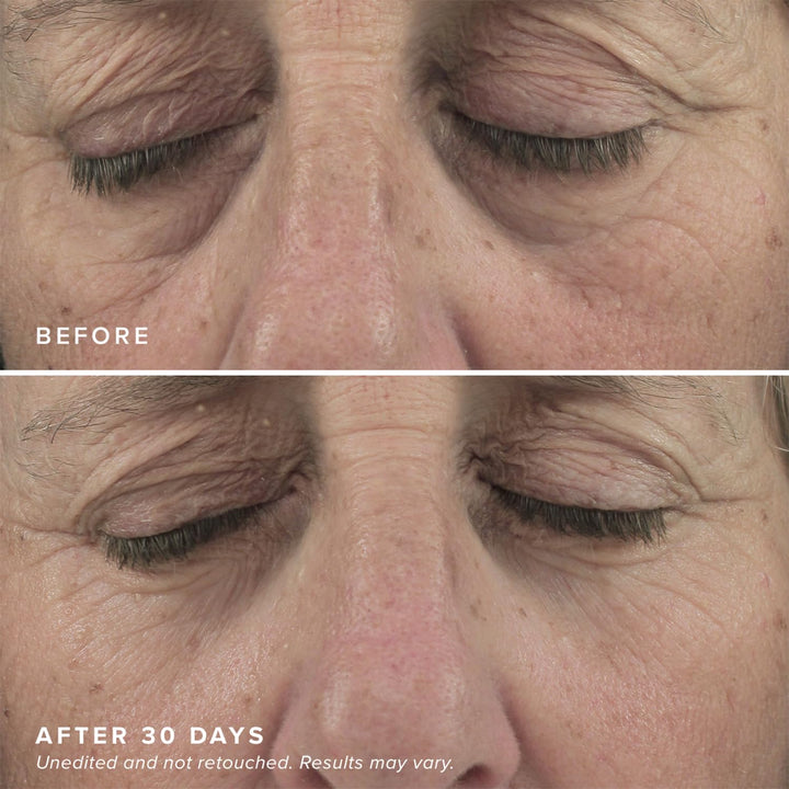 Brightening Eye Masks (30 Pairs) - Caffeine Eye Masks for Dark Circles and Puffiness with Hyaluronic Acid, Eye Patches for Puffy Eyes