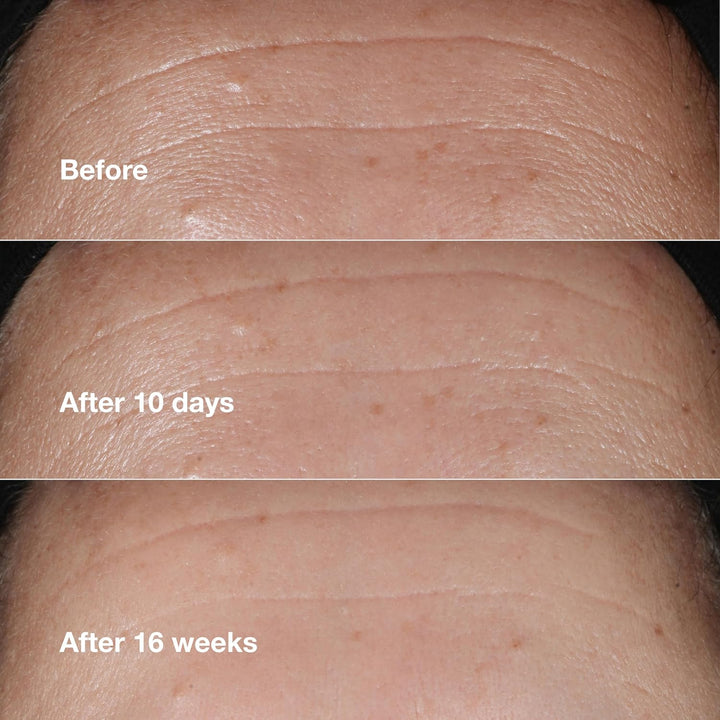 Smart Skin School Supplies: Smooth + Renew Lab Gift Set | Smart Clinical Repair Wrinkle Correcting Cream, Face Serum + Eye Cream | Anti-Aging + Hydrating | Includes 3 Travel Size Pieces