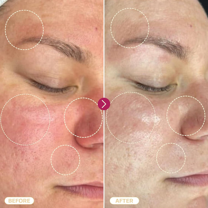 Hypochlorous Acid Spray for Face & Skin | 8 Oz | Facial Spray Daily Skin Repair Solution for Sensitive Skin, Redness, Irritations, Eczema, Acne. Hypochlrous HOCL Molecule Spray