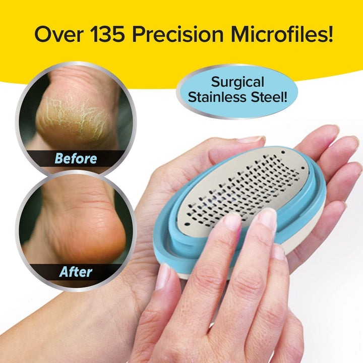 Classic Callus Remover, as Seen on TV, New Look, Safely & Painlessly Remove Tough Calluses Dry Skin to Reveal Smooth Soft Feet, 135 Precision Micro-Blades, Traps Shavings
