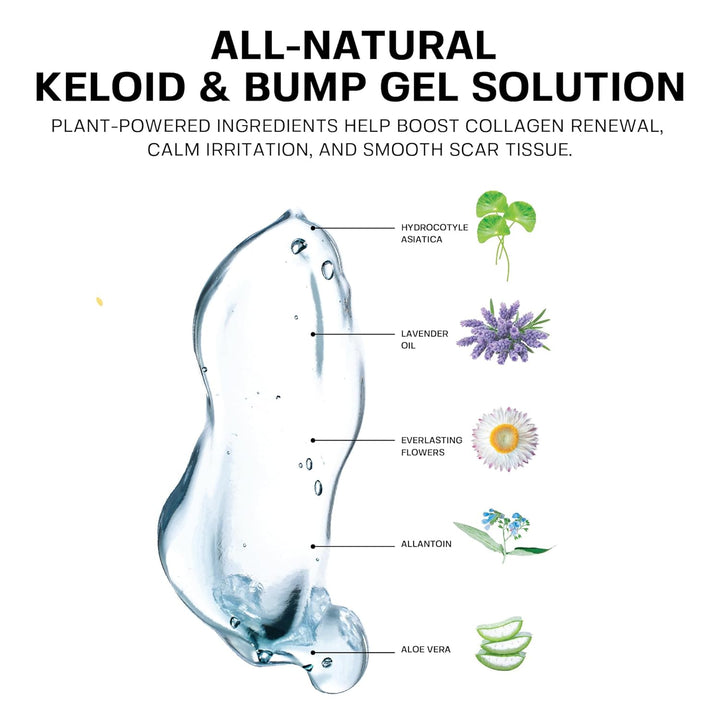 Keloid Bump Removal Gel | Natural Piercing Bump Treatment & Keloid Scar Gel | Keloid Scar Removal for All Scars, Keloids & Piercing Bumps | Soothing Piercing Aftercare | 2 Oz