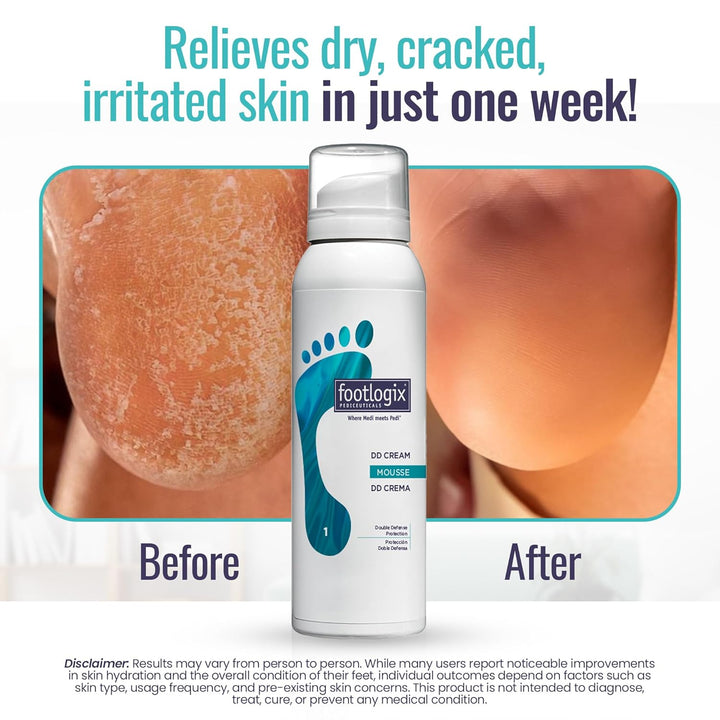 DD Cream Mousse, White, 4.23 Ounce