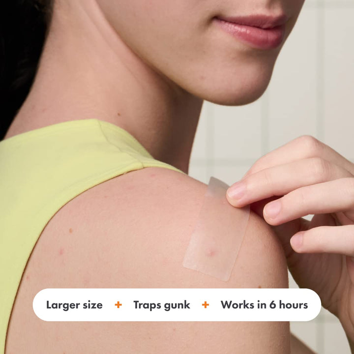 Surface Large Pimple Patches for Face from , Acne Spot for Body, Cheek, Forehead, and Chin, Pimple Stickers, Hydrocolloid Covers, Vegan-Friendly, 10 Count