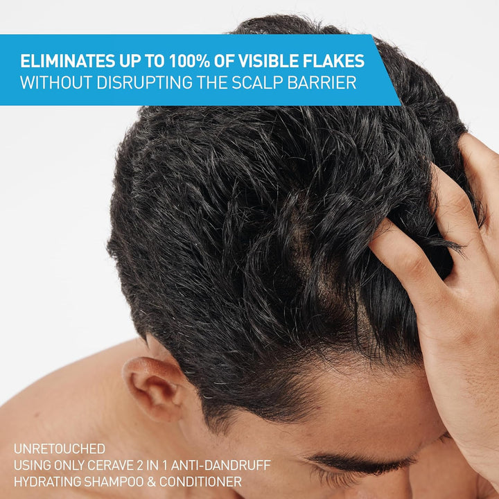 2 in 1 Hydrating anti Dandruff Shampoo and Conditioner, 1% Pyrithione Zinc Dandruff Treatment, Color Safe & Sulfate Free Shampoo and Conditioner, Helps Eliminate Dandruff & Relieve Itchy Scalp