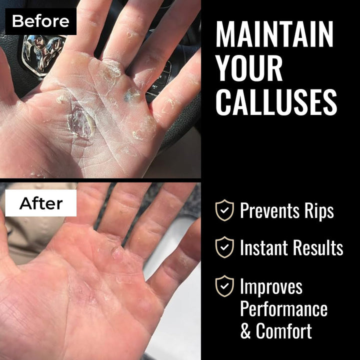 Callus Remover File for Hands - Durable Aluminum Tool for Callus Care and Dead Skin Removal - Includes Nourishing Salve - Ideal for Athletes, Climbers, and Gym Enthusiasts