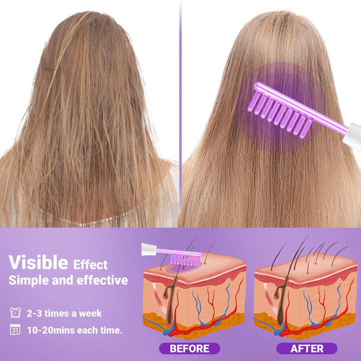 High Frequency Facial Wand- Portable Handheld High Frequency Facial Machine Skin Facial Wand with 4 Violet Tubes