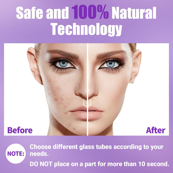 High Frequency Facial Wand- Portable Handheld High Frequency Facial Machine Skin Facial Wand with 4 Violet Tubes