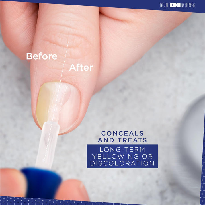 Nail Whitener, Professional Optical Brightening Basecoat Nail Concealer Polish with Vitamin E, Lemon Lime Extracts, Made in USA, 15Ml