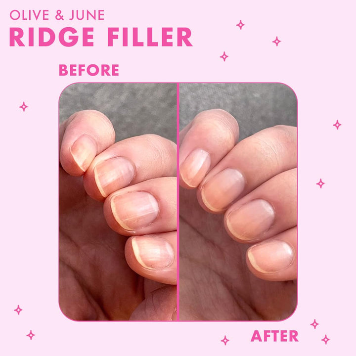 Ridge Filler | Smoothing Nail Base Coat for Ridges | Vitamin E & Silica Formula | Smooth, Flawless Canvas for Polish | Vegan & Cruelty-Free | Salon-Quality Mani at Home (0.46 Fl Oz)