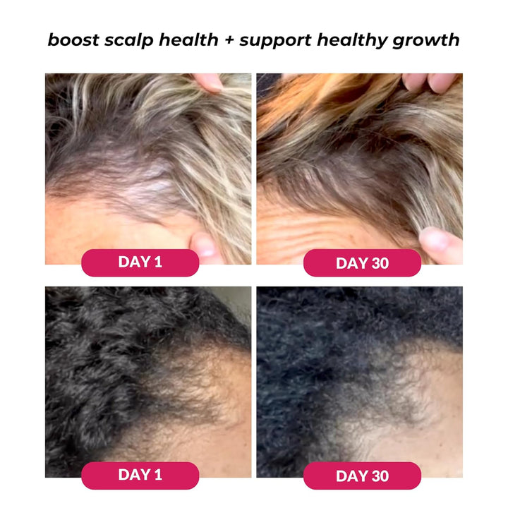 - Healthy Scalp Serum Growth Hair Activator, Turmeric & Basil Extracts for Deep Moisturizing and Thicker Full Hair, Vegan, 50Ml