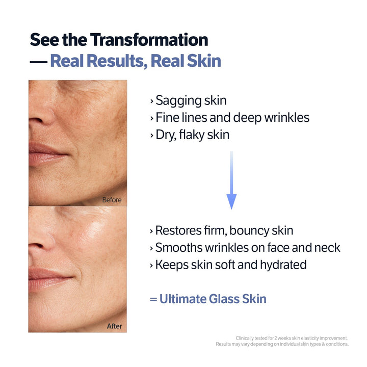 Deep Collagen Retinol Power Boosting Capsule Face & Neck Cream | Microneedling, White Spicules, Skin Firming, Hydration for Dry Skin, Wrinkles, Face Moisturizer, 1.69 Fl.Oz