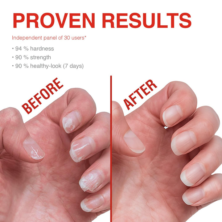 Nail Strengthener and Growth, Natural Nail Strengthening Clear Nail Polish Repair Treatment, Nail Growth & Conditioning, Stops Splits, Chips, Cracks & Strengthens Damaged and Thin Nails