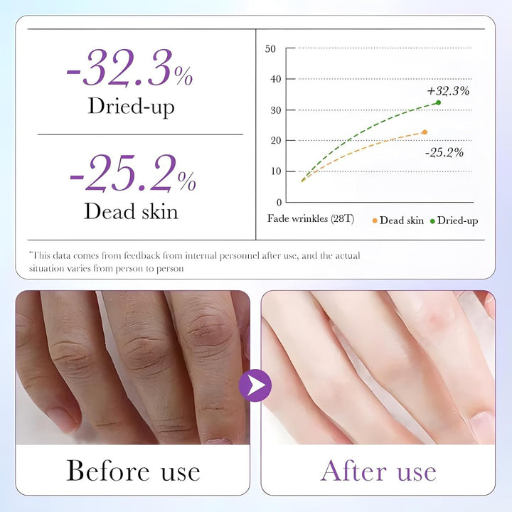 6 Pairs of Hand Masks Moisturizing Glove, Hydrating Hand Masks for Dry Peeling Hands, Exfoliating Collagen Gloves for Smooth Hands (Lavender)