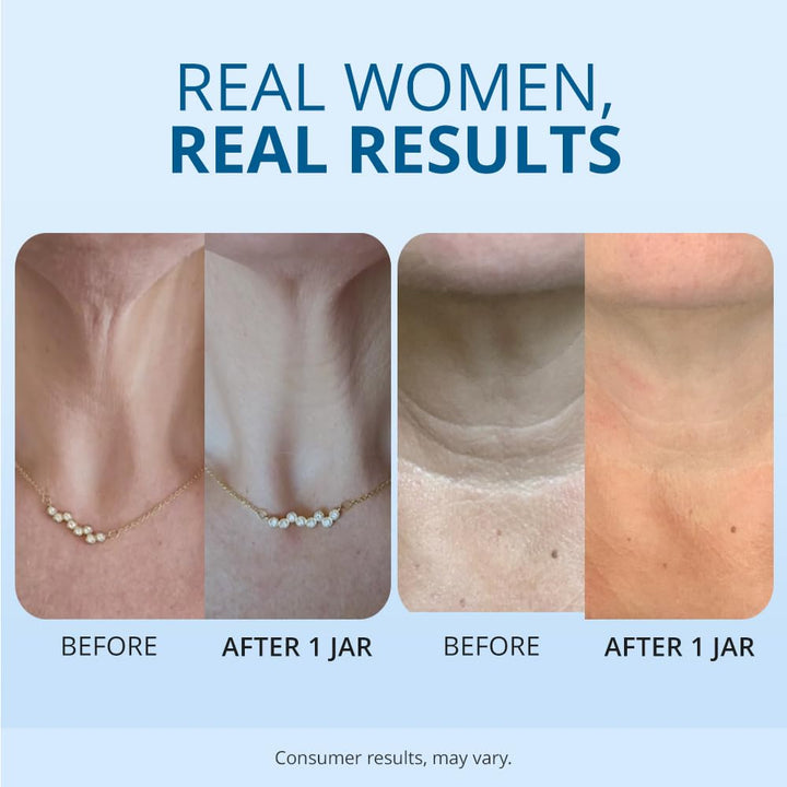 Tighten and Lift Neck Cream- Clinically Tested