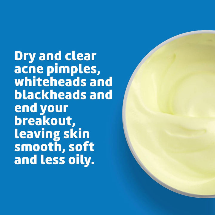 10% Sulfur Ointment - Cystic Acne Treatment for Face and Body - Daily 10 Min Spot Treatment Mask - Safe and Effective Game Changing Hormonal Acne Treatment That Clears up Pimples - 2.6 Oz