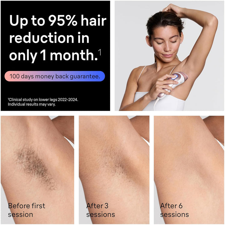 Smart IPL, Skin I·Expert Pro 7: at Home Laser Hair Removal, Permanent Visible Hair Reduction, Holiday Gifts for Women and Men with Free App, Vanity Case, Venus Razor, 3 Smart Heads, IPL7243
