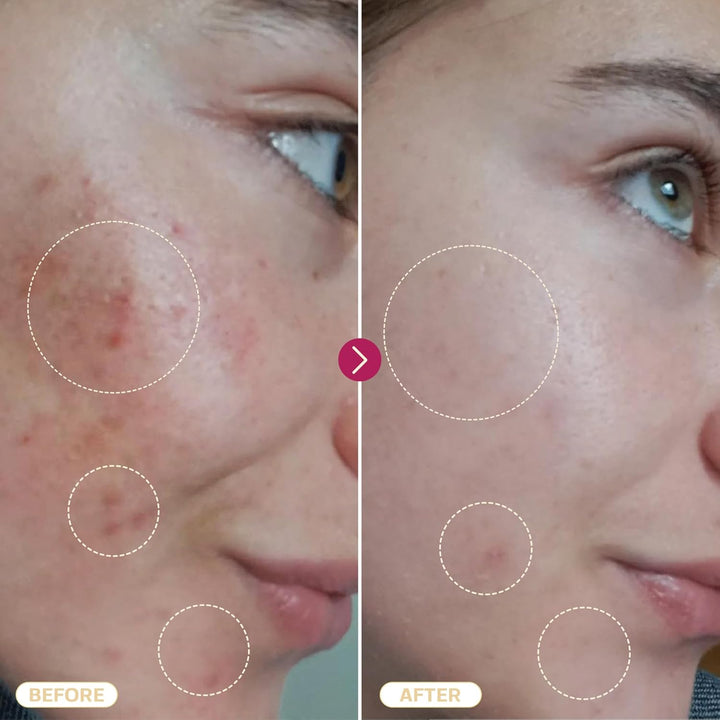 Hypochlorous Acid Spray for Face & Skin | 8 Oz | Facial Spray Daily Skin Repair Solution for Sensitive Skin, Redness, Irritations, Eczema, Acne. Hypochlrous HOCL Molecule Spray