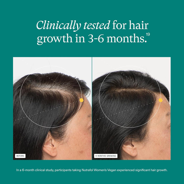 Women'S Hair Growth Supplements, for Women 18-44 Years Old, Clinically Tested for Visibly Thicker, Stronger Hair, 100% Vegan Ingredients, Dermatologist Recommended - 1 Month Supply