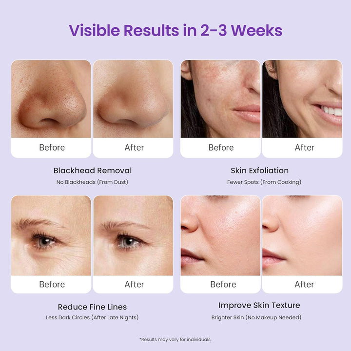 Diamond Microdermabrasion Machine Professional, 3 in 1 Dermabrasion Facial Peeling Skin Care Device for Salon Personal Home Use