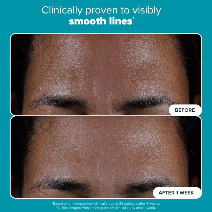 SKIN PERFECTING 2% BHA Liquid Exfoliant with Salicylic Acid, Facial Polish for Enlarged Pores, Wrinkles & Fine Lines, Suitable for Blackhead-Prone Skin, Fragrance-Free