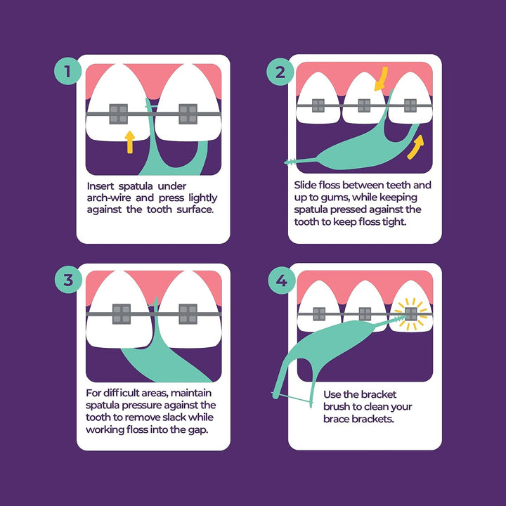 Orthodontic Flossers for Braces, 40 Count (Pack of 1), Ortho Picks for Adults & Kids, Fits under Arch Wire, Non-Damaging, Encourage Flossing Habits