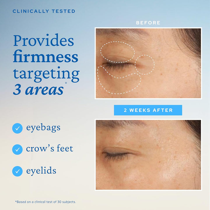 Peptide Eye Bomb, Anti-Aging Eye Cream for Wrinkles, Fine Lines, Crow’S Feet & Eye Bags, 48Hr Hydration with Ceramide, Squalane, Caffeine, Dermatologist-Tested Korean Skincare, 0.84 Fl.Oz