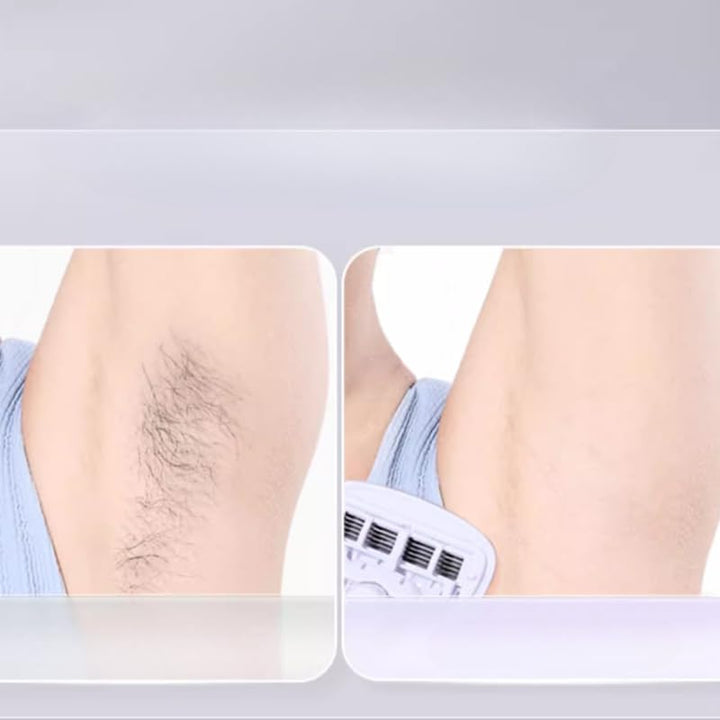 Goodie Hair Shaver, Women'S Private Area Shaver, Intimate Shaver, Armpit Hair, Leg Short-Handled Fairy Powder 5 * 8.5CM*1 Box